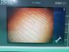 KARL STORZ Video Intubation Scope 11303-BNX Laryngoscope