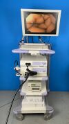 OLYMPUS CV-180 Gastroscope