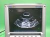 SONOSITE P21x/5-1 MHz Ultrasound Transducer Probe P07698-21 (TESTED) Ultrasound Transducer