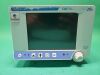 ORIDION Capnostream 20p etcO2 Monitor w/ printer Co2 Monitor