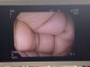 PENTAX EG-2790i Gastroscope
