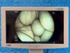 FUJINON EG-580NW YOM: 2013 with case and valves Endoscope
