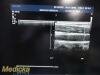 PHILIPS L9-3 Linear Array Ultrasound Transducer