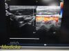 PHILIPS L9-3 Linear Array Ultrasound Transducer