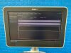 PHILIPS EPIQ ELITE 5G xMatrix Pure Wave Ultrasound YOM: 2014 with 5x Probes