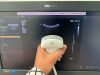 PHILIPS EPIQ ELITE 5G xMatrix Pure Wave Ultrasound YOM: 2014 with 5x Probes