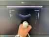 PHILIPS EPIQ ELITE 5G xMatrix Pure Wave Ultrasound YOM: 2014 with 5x Probes
