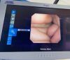 KARL STORZ 11278 VSUA Ureteroscope