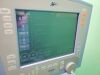 CAREFUSION VIASYS AVEA 17212-00 Ventilator