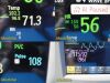 PHILIPS 2014  Intellivue 862135 MP30 , MASIMO SpO2 W/ Leads & Module~ Monitor