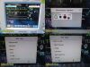 PHILIPS 2014  Intellivue 862135 MP30 , MASIMO SpO2 W/ Leads & Module~ Monitor