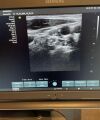 SIEMENS X700 Ultrasound - Shared Service