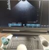 SIEMENS X700 Ultrasound - Shared Service