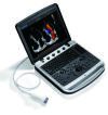 CHISON SonoBook 9 Ultrasound - Cardiac