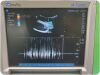 SONOSITE C60x Curved Array Abdominal Ultrasound Machine Transducer for M-Turbo Ultrasound Transducer