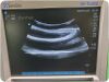 SONOSITE C60x Curved Array Abdominal Ultrasound Machine Transducer for M-Turbo Ultrasound Transducer