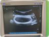 SONOSITE C60x Curved Array Abdominal Ultrasound Machine Transducer for M-Turbo Ultrasound Transducer