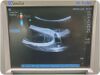 SONOSITE C60x Curved Array Abdominal Ultrasound Machine Transducer for M-Turbo Ultrasound Transducer