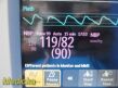 PHILIPS 2012  Intellivue MP30,W/ Leads & MMS Module Masiom Set SpO2~ Monitor