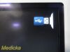 VERATHON Medical 0570-0338 Glidescope Video Monitor