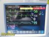PHILIPS 2011  MP30,(M8002A) W/ Patient Leads & M3001A MMS Module ~ Monitor