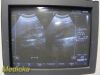 PHILIPS C9-4 Convex Array Ultrasound Transducer