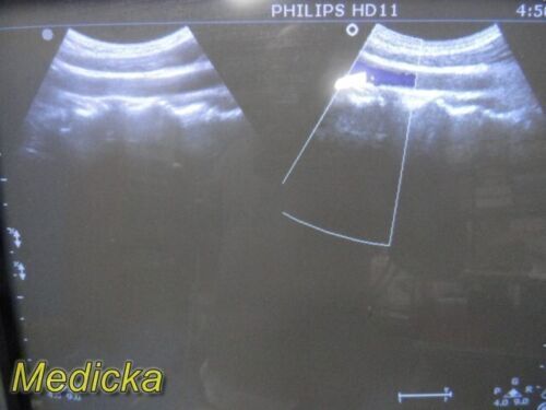 PHILIPS C9-4 Convex Array Ultrasound Transducer