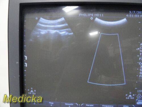 PHILIPS C9-4 Convex Array Ultrasound Transducer