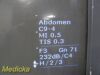 PHILIPS C9-4 Convex Array Ultrasound Transducer