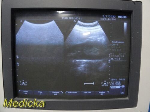 PHILIPS C9-4 Convex Array Ultrasound Transducer