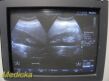 PHILIPS C9-4 Convex Array Ultrasound Transducer