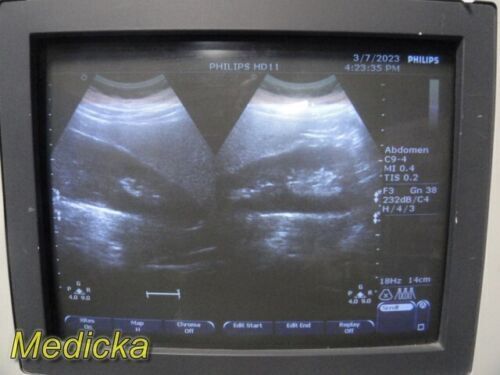 PHILIPS C9-4 Convex Array Ultrasound Transducer