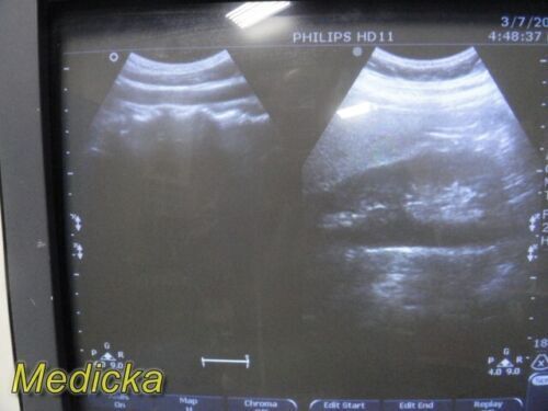 PHILIPS C9-4 Convex Array Ultrasound Transducer