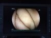 FUJINON EC-600HL Colonoscope