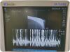SONOSITE HFL38x Linear Probe Edge / M-Turbo (TESTED) Ultrasound Transducer