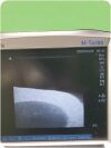 SONOSITE HFL38x Linear Probe Edge / M-Turbo (TESTED) Ultrasound Transducer