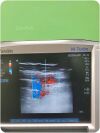 SONOSITE HFL38x Linear Probe Edge / M-Turbo (TESTED) Ultrasound Transducer