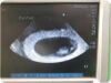 SONOSITE P21x Ultrasound Transducer