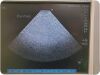 SONOSITE P21x Ultrasound Transducer