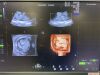 GE Voluson S8 Ultrasound - OB / GYN