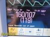PHILIPS 2010  862135, MP30 W/ M3001A MMS Module MASIMO SpO2& Leads ~ Monitor