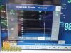 PHILIPS 2010  862135, MP30 W/ M3001A MMS Module MASIMO SpO2& Leads ~ Monitor