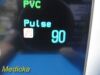 PHILIPS 2010  862135, MP30 W/ M3001A MMS Module MASIMO SpO2& Leads ~ Monitor