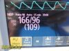 PHILIPS 2012  MP30, W/ NBP,SpO2,ECG,Temp Leads & MMS Module, MASIMO : Monitor