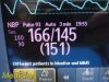 PHILIPS 2014  Intellivue MP30  ,W/ Masimo M3001A MMS Module & Leads~ Monitor