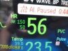 PHILIPS 2014  MP30 ,W/ M3001A Module Masimo SpO2 & NEW Patient Leads~ Monitor