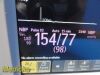 PHILIPS 2012  MP30 ,W/ Leads & Module (NBP IBP SpO2 ECG Temp Print) ~ Monitor