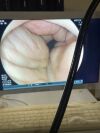 FUJINON EC-590ZW3/M Colonoscope