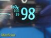 PHILIPS 2010  M8002A MP30 ,W/ M3001A Module Masimo & Patient Leads ~ Monitor
