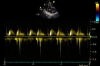 GE 3SC-RS Ultrasound Transducer